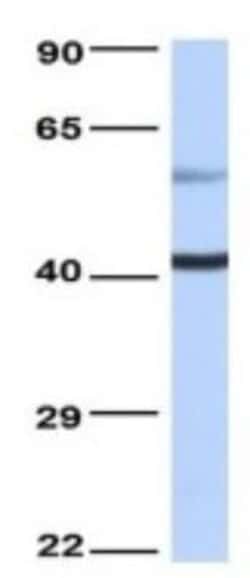 TLX/NR2E1 Rabbit anti-Human, Polyclonal, Novus Biologicals 100 &mu;g; Unconjugated:Antibodies,